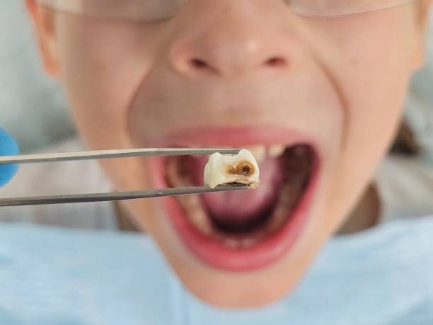 Best Tooth Infection Emergency Dentist  in Madison Lake, MN